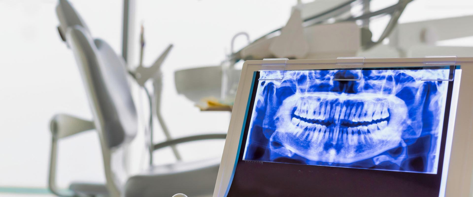 Dental billing and CDT codes