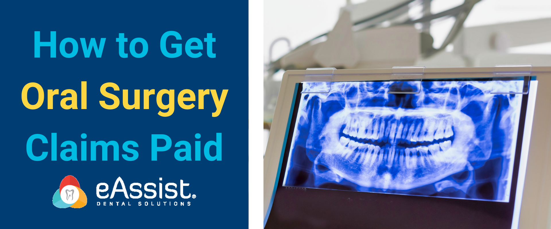 How to Get Oral Surgery Claims Paid